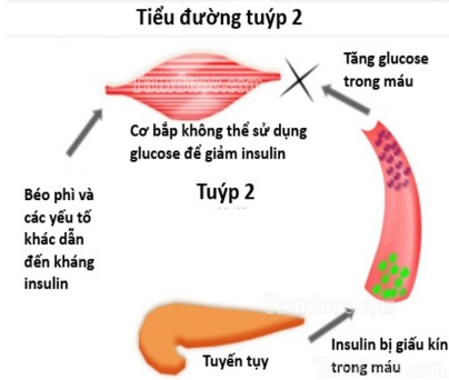 Tieuduong01